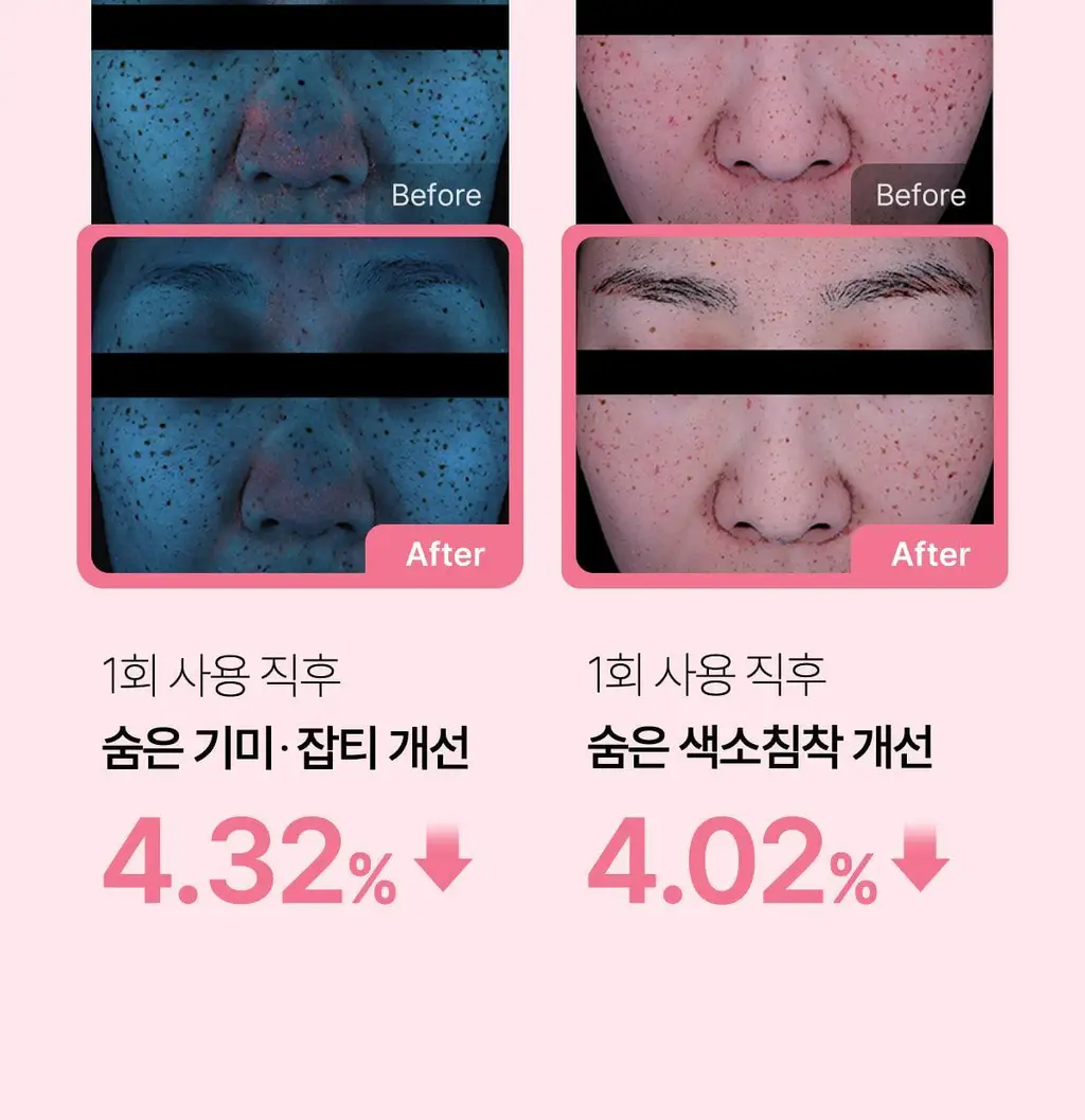 [NEW/5+1매 단독기획] 메디큐브 PDRN 핑크 펩타이드 앰플 마스크 5매 기획 (+1매) 상세페이지 18
